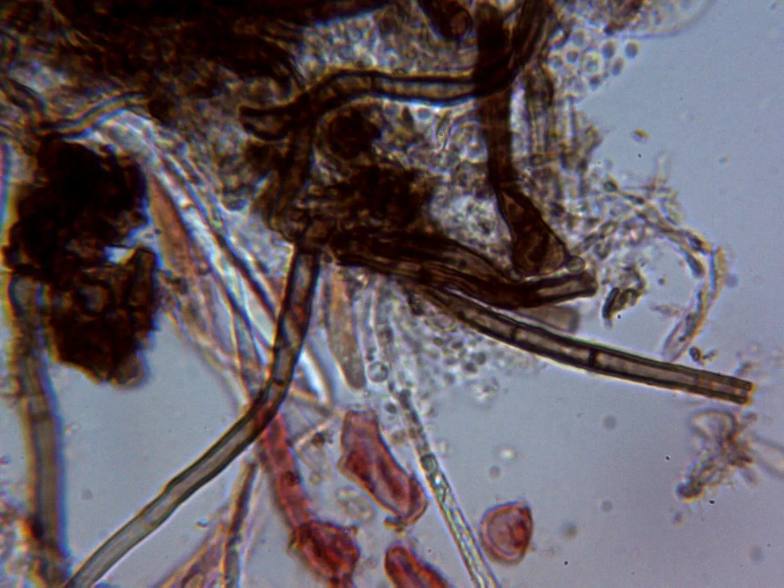Microscopía de Mollisia rosae - 10 - Hifas subiculares 1